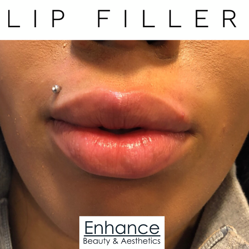Enhance Clinic UK
