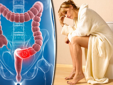 Heads up To Your Confusion Over Problems In Anal Canal post image