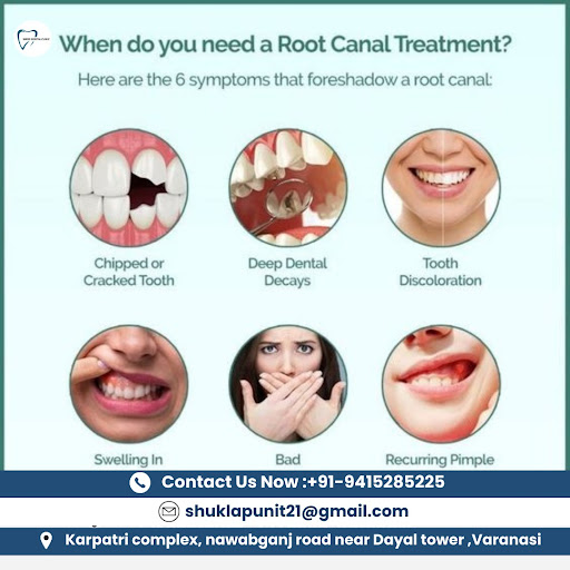 When do you need a Root Canal Treatment?