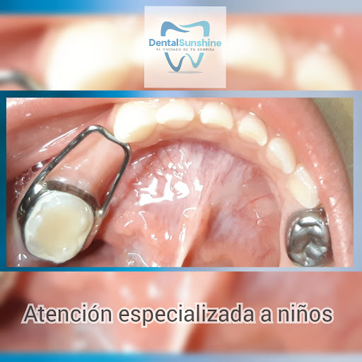 Dental Sunshine Gallery - Mexico