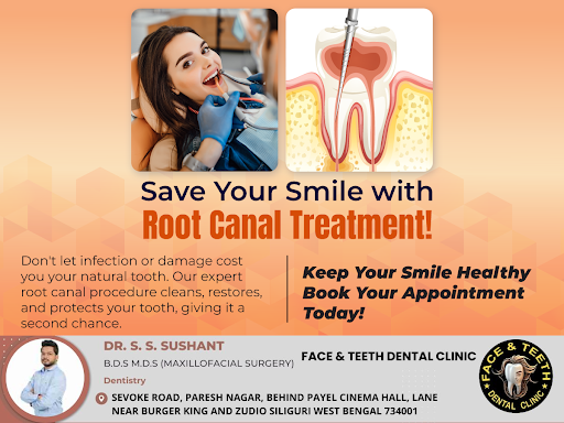 A root canal is a safe and effective procedure designed to save severely infected or damaged teet… post image