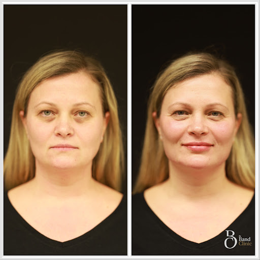 Wellface® - Aesthetics Clinic