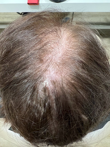 Schönheitswerk-Sybille Rieck Professionelle Haarverlängerung/Kosmetik - Thumbnail