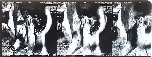 Catherine Mormile DPT, doctor of physical therapy - Thumbnail