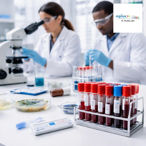 Timely and accurate diagnosis is crucial for treating infections and tuberculosis. At Agilus Diag… post image