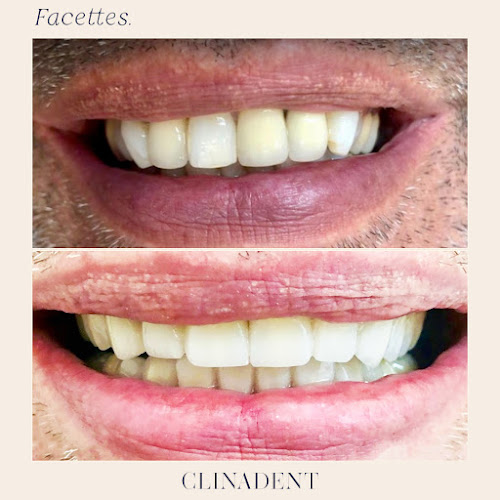 Clinadent - Centre Dentaire Marseille 8, Negresko - Dentiste