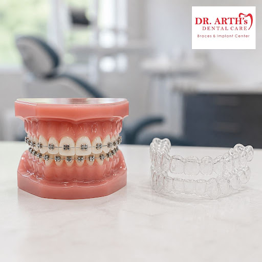 Confused between traditional metal braces and modern clear aligners? At Dr Arths Dental Care Brac… post image