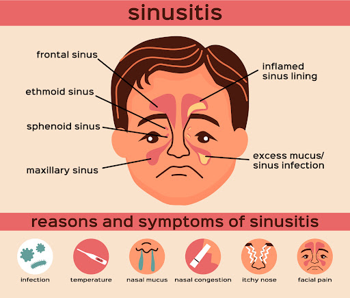 An ENT specialist may assess your symptoms and medical history and recommend appropriate treatmen… post image