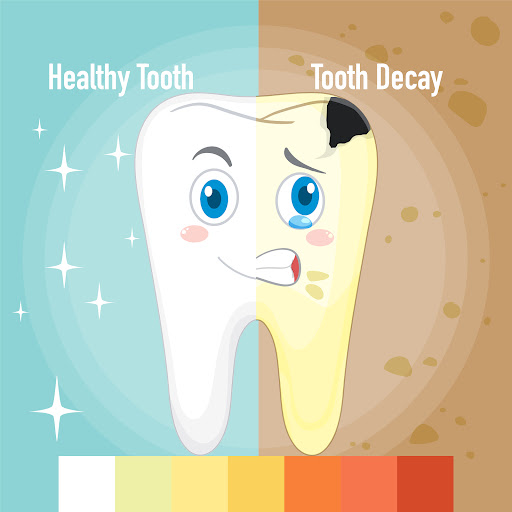 Prevent Tooth Decay with Expert Dental Care by Dr. Nilesh Khandare