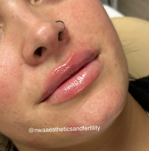 NWA Aesthetics and Fertility