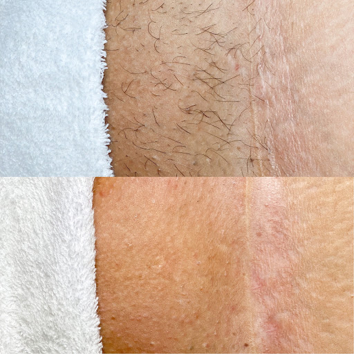 Sugar&Skin Aesthetics - Thumbnail