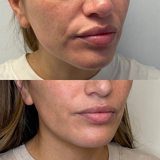 The Aesthetic Method Medical Spa