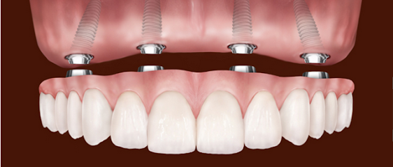 Brand New Smile Dental Implant Center
