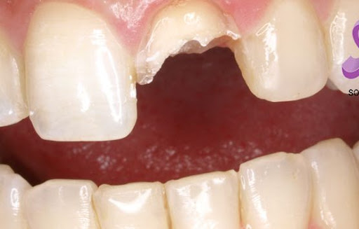 Centro Dental Madrid - Thumbnail