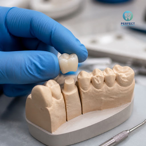 Curious about how ceramic crowns can restore your smile? At Perfect Dental Clinic in Paschim Viha… post image