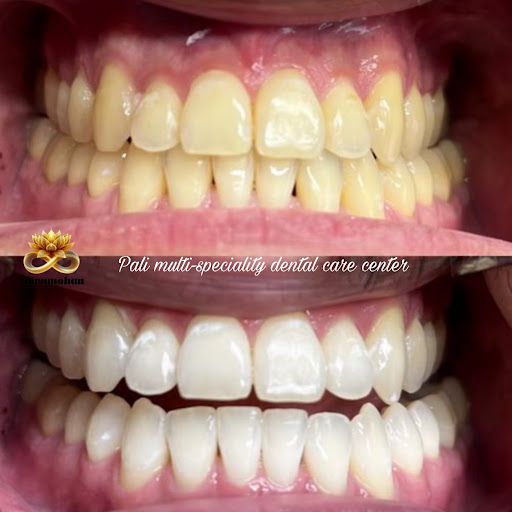 We offer comprehensive dental care including check-ups, cleaning, tooth-colored fillings, root ca…
