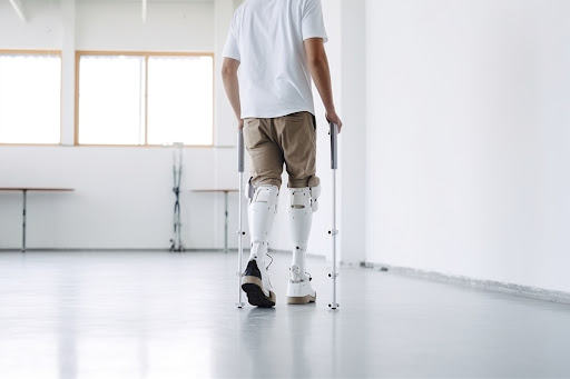 Amputee rehabilitation is a crucial step towards regaining independence and improving quality of… post image
