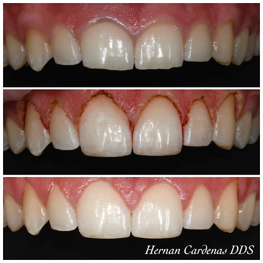 Cardenas Hernan DDS - Thumbnail