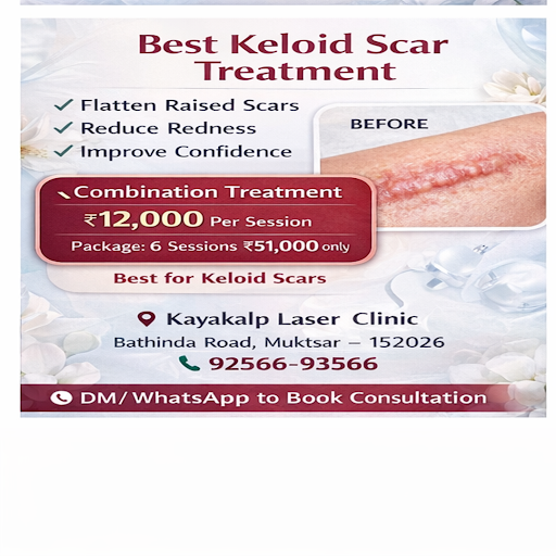 Keloid scars don’t go away on their own. post image