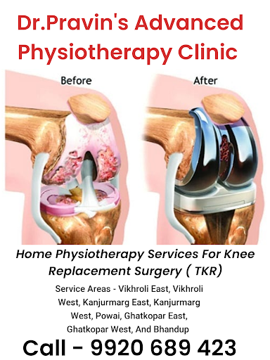 Post Total Knee Replacement (TKR) Home Physiotherapy in Vikhroli – Dr. Pravin’s Advanced Physioth… post image