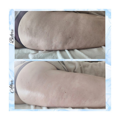 OCÉANE B - Massage à domicile - Drainage Renata Franca - Maderotherapie - Thumbnail