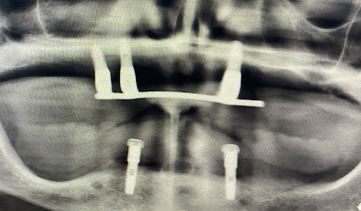 Fexdental - Visual