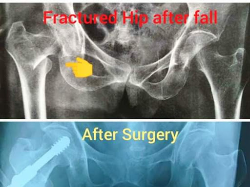 Best Surgeries At Most affordable Cost post image