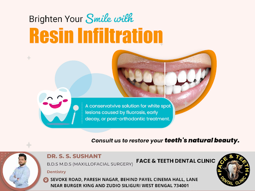 Resin infiltration is a noninvasive cosmetic dentistry technique designed to improve the appearan… post image