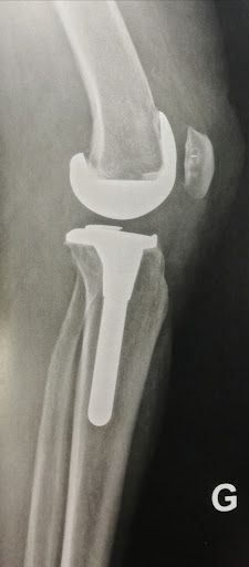 Dr Majed ISSA-Chirurgien orthopédiste-Sport et arthrose-Paris Lilas - Thumbnail