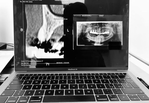 Studio Dentistico Dott.ssa Elena Gasparini - Thumbnail