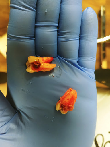 Oral Surgery Kansas Gallery - United States