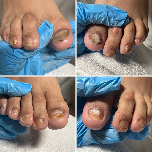Las Vegas Medi Pedi Center & Spa LLC - Thumbnail
