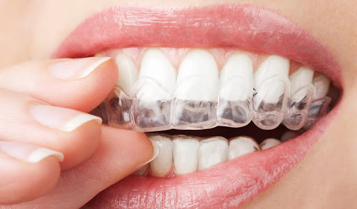 Odontium Clínica Dental en Cuenca | Dr. Jesús Cañas Muñoz - Thumbnail
