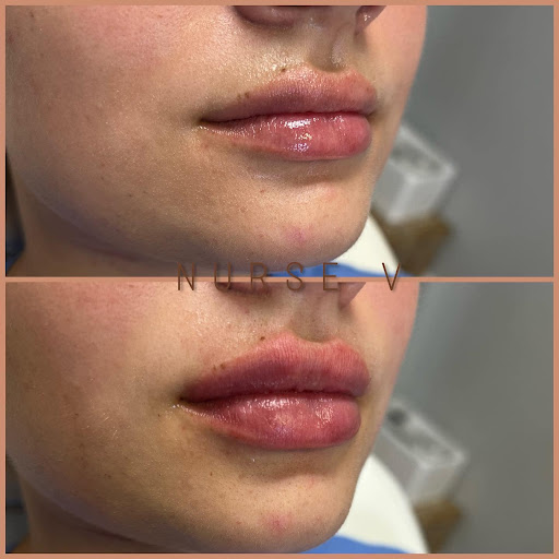 Nurse V Beauty LLC