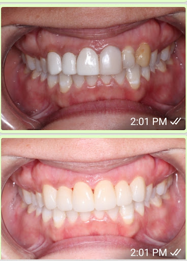 Dr.Raouf Ramzy. Hope Dental Clinic - صورة 5