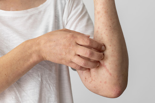At Tanush Skin Care Clinic in Bhiwandi, patients receive personalised Dermatology care with a foc… post image