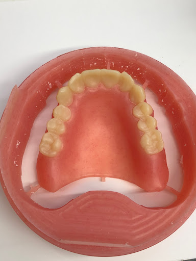 Dental Prosthetics By Richard & Cindy - Thumbnail