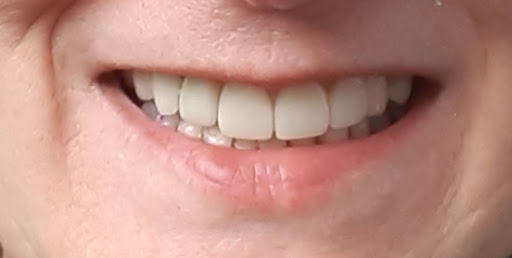 Seaview Dental Arts - Thumbnail