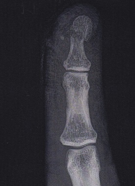 Westmead Hand Therapy Centre - Thumbnail