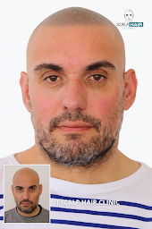 Photo n°19 de Scalp-Hair clinic à Paris (Service de remplacement capillaire)