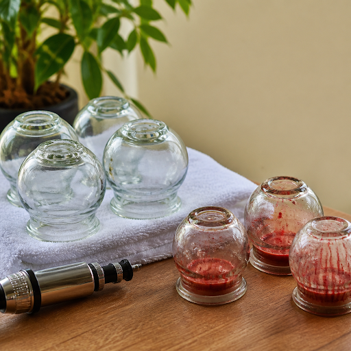 Cupping therapy is becoming popular among people looking for natural pain relief and relaxation.… post image