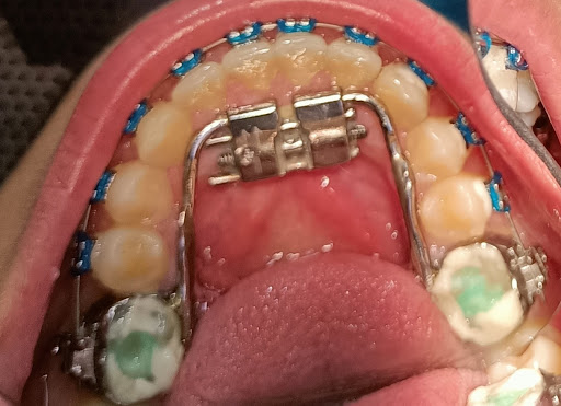 DENTAL MONTALVO - Thumbnail
