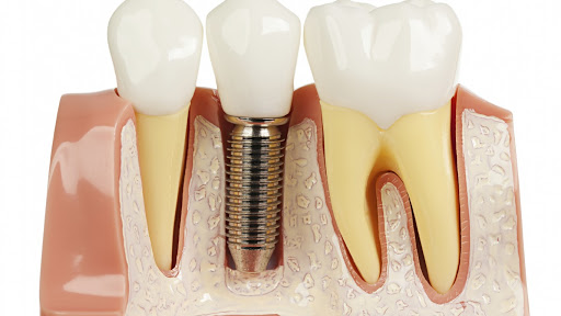 NY Ave Dental Gallery - United States