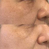 小顔・素肌美フェイシャル remiu