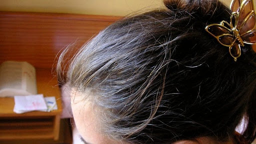 Worried about premature greying? Here are 5 ways to slow it down