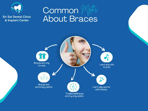 Breaking Down the Myths About Braces! post image