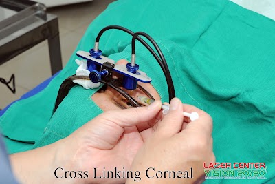 Photos of Laser Center Vision 20/20
