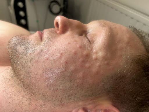 B Pretty - Thumbnail