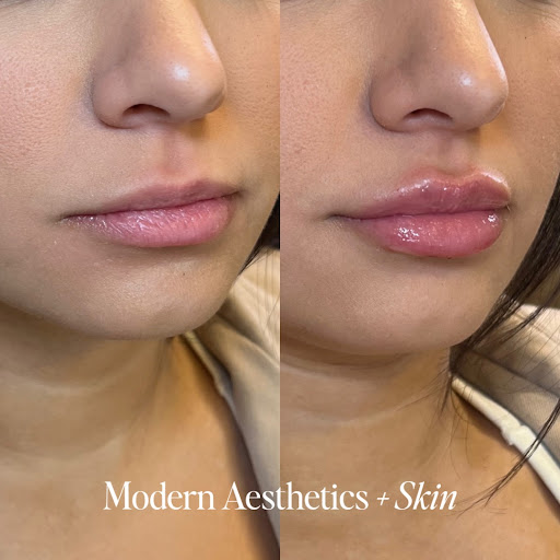 Modern Aesthetics + Skin Medical Spa