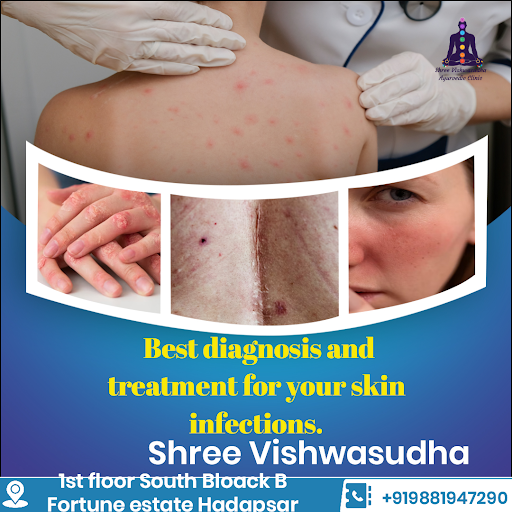 Ayurvedic Treatments for Psoriasis